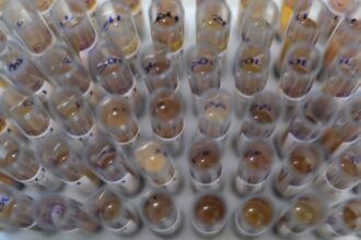 uso-de-medicamento-oferecido-no-sus-reduz-casos-de-malaria-no-brasil